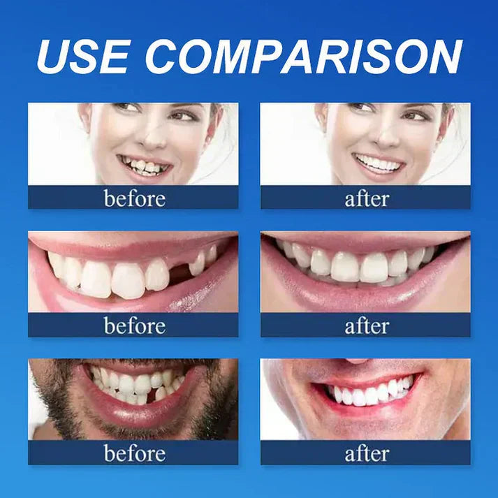 ⏰Ends Today: 50% OFF!  Custom-Fit — Designed for Comfort and a Natural-Looking Smile